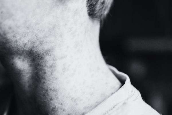 Galeria-de-2-imagenes-1-5