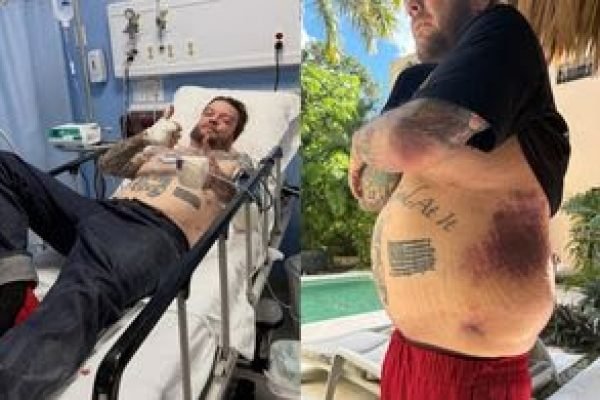 corey-harrison-sufrio-accidente-mexico