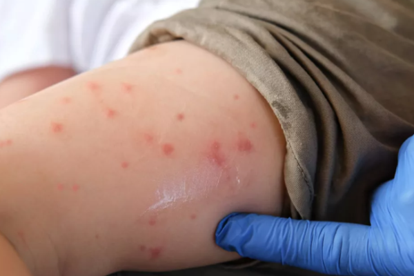 imagen_2026-03-15_142936808